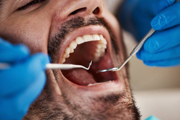 Best Emergency Dentist for Special Needs Patients in Pittsfield, IL